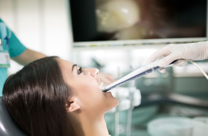 Cámara intraoral