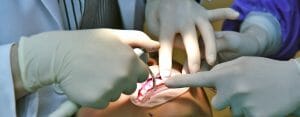 cirugía oral Clínica de la Torre