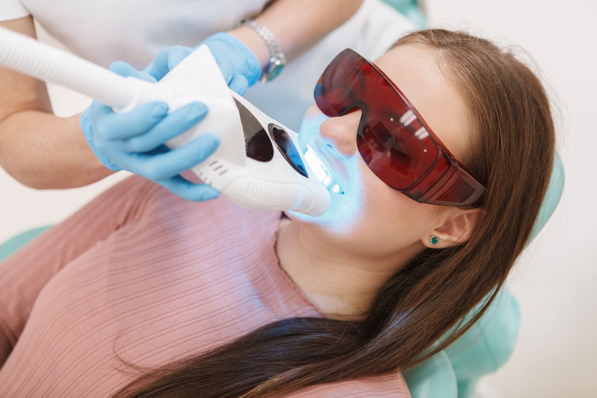 Blanqueamiento dental_ mitos y realidades