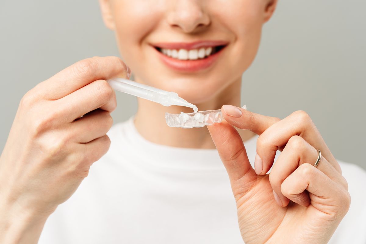 Blanqueamiento dental_ mitos y realidades_Blanqueamiento dental_ mitos y realidades